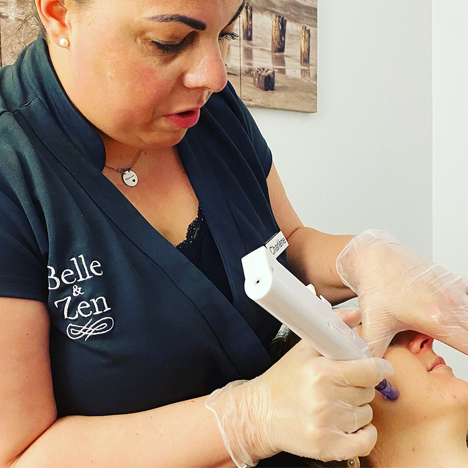 Soins visage haute technologie 9 micro needling