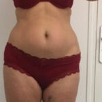 Les soins minceur 6 vouloir affiner sa silhouette à Vendôme