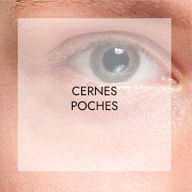 Soins visage haute technologie 8 cernes poches
