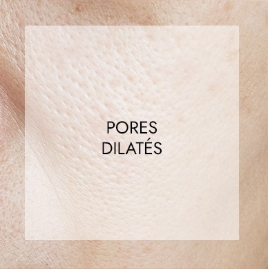 Soins visage haute technologie 5 pores dilates