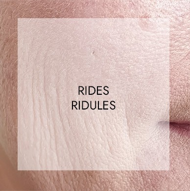 Soins visage haute technologie 2 rides ridules
