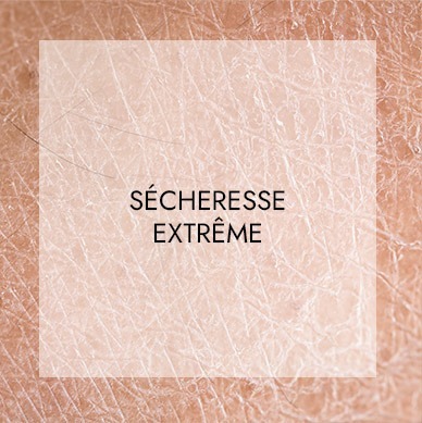 Soins visage haute technologie 6 secheresse
