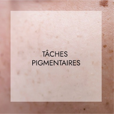 Soins visage haute technologie 1 taches pigmentaires
