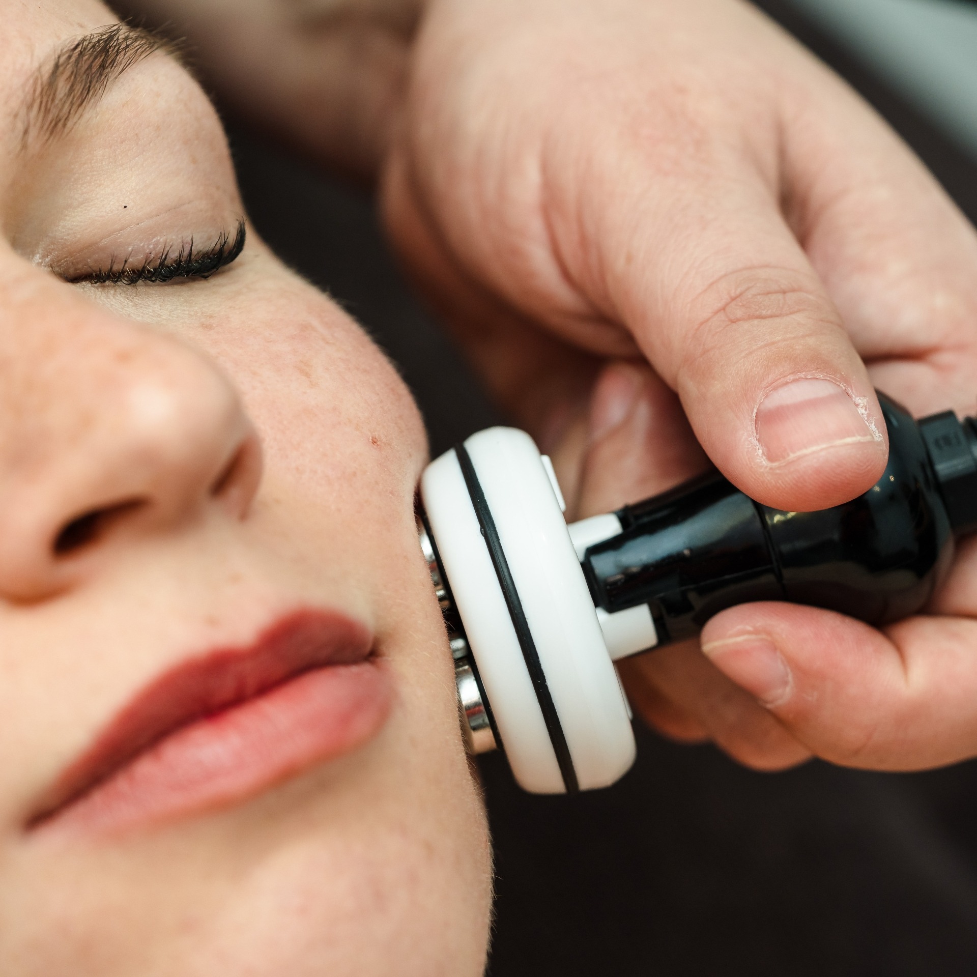 soins visage haute technologie à Vendôme - expertise anti imperfection du visage